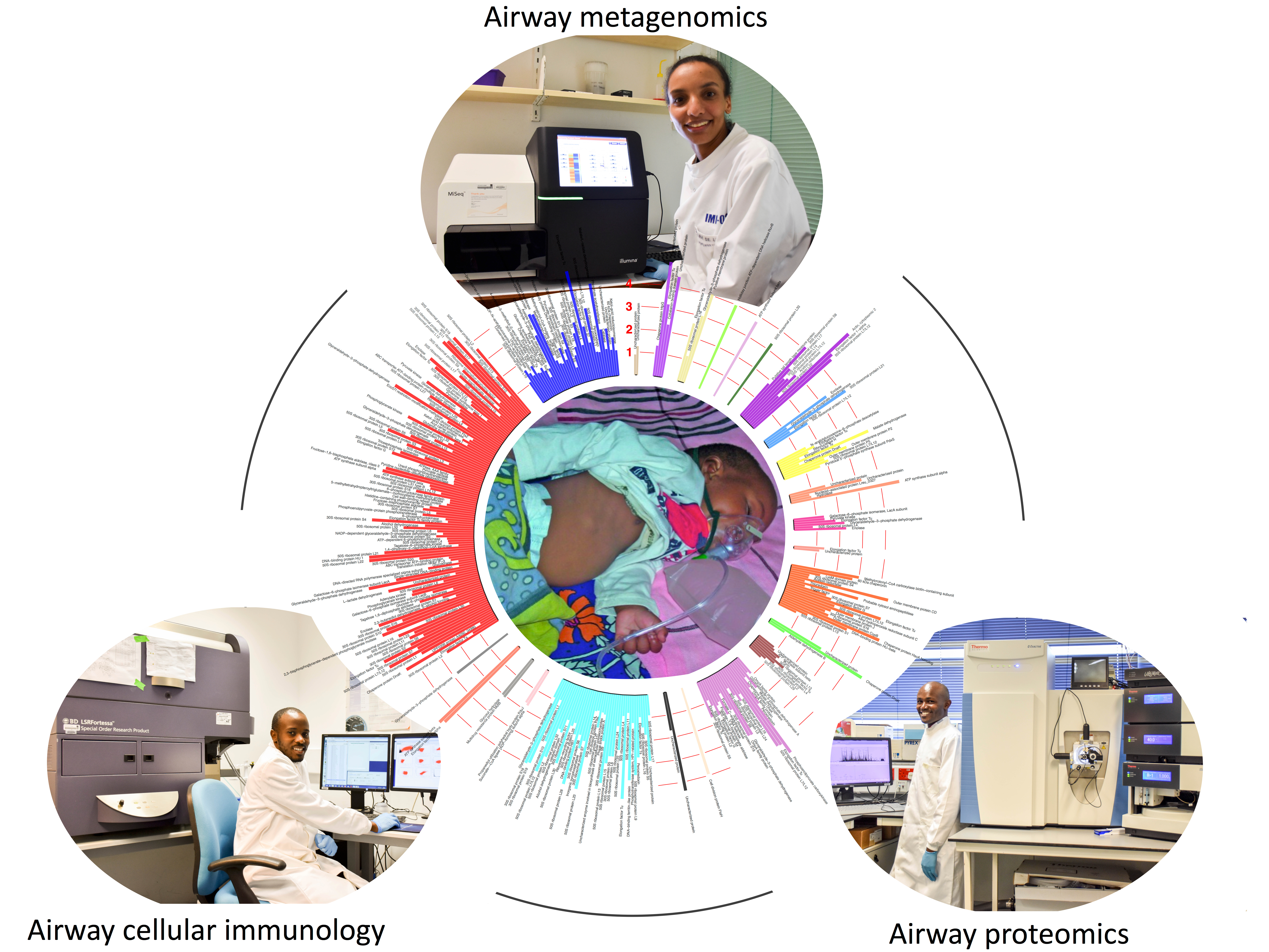Airway response to respiratory syncytial virus has incidental antibacterial effects