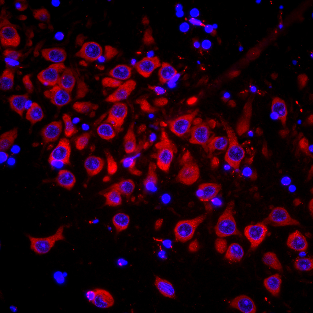 Identification of a divalent siRNA chemical scaffold for potent and sustained modulation of gene expression throughout the central nervous system.