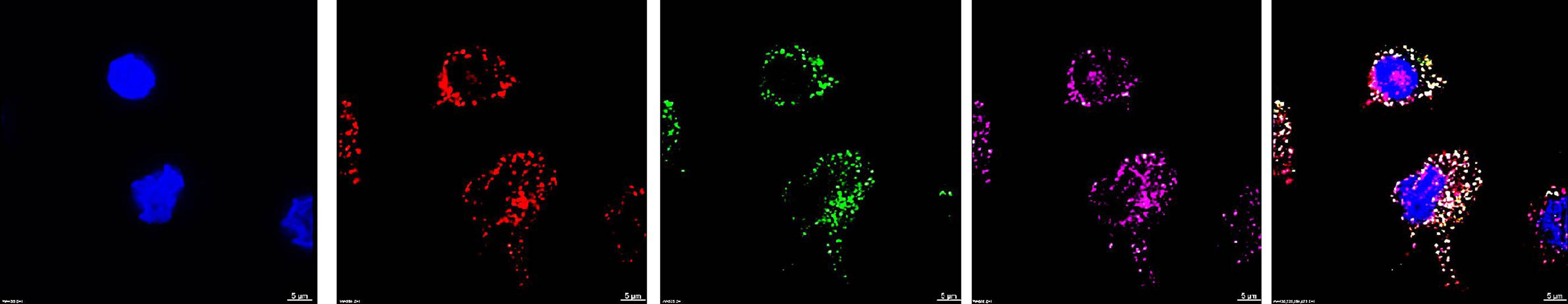 Pneumococcus hijacks a host receptor to evade the immune response 