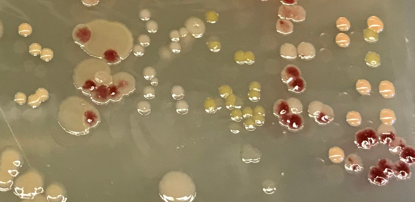 Microbial experiments reveal surprising tradeoff