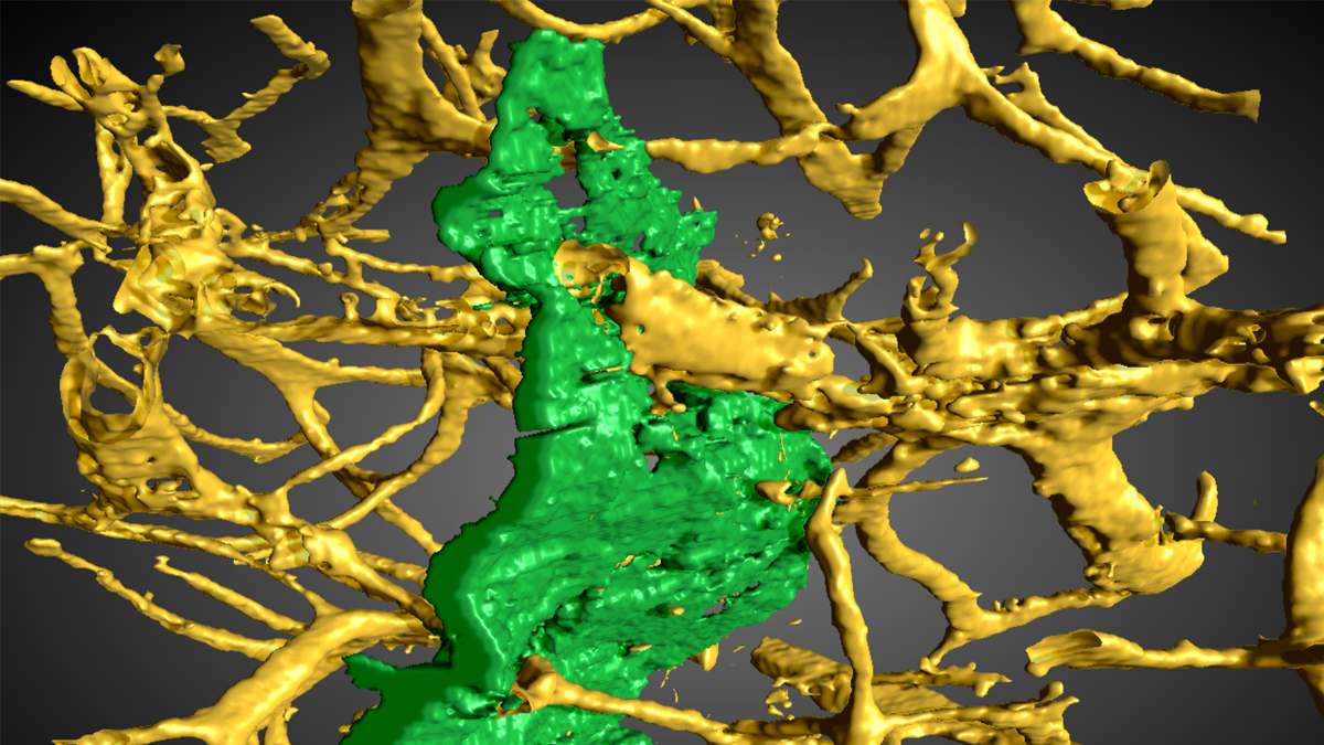 Cracking the code: Using deep learning to study bone fracture micro-mechanics and toughness