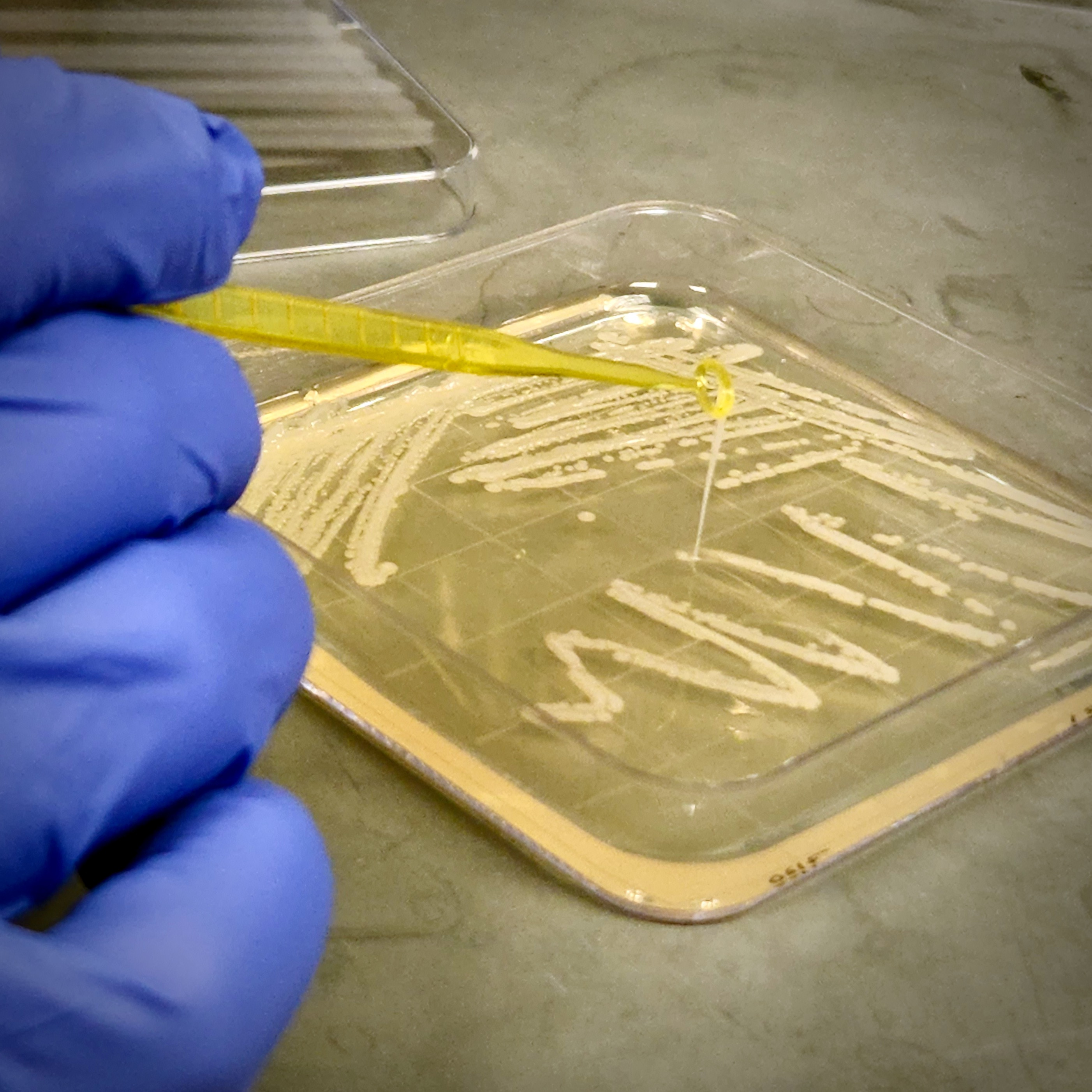 The whole nine yards: an integrated approach to understanding Klebsiella infection