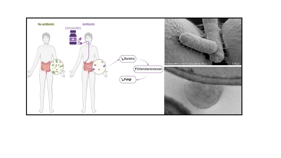Antibiotic treatment also affects the intestinal fungal microbiota