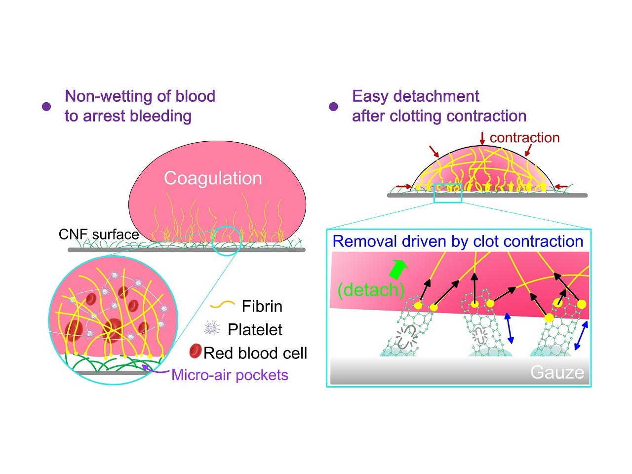 Superhydrophobic Biomaterial Makes an Ideal Gauze: Rapid Bleeding Stoppage and Easy Removal After Healing Prevents Infections 