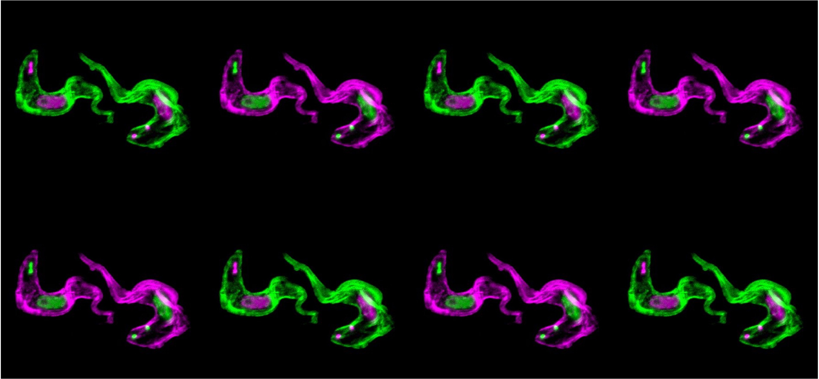 A Molecular Shredder at the Source: How Trypanosomes Fine-Tune Their Surface Coat