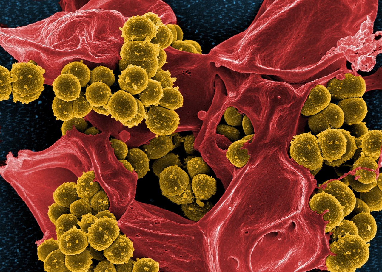 Microbiome 2.0 - or what to do when you have no hits 