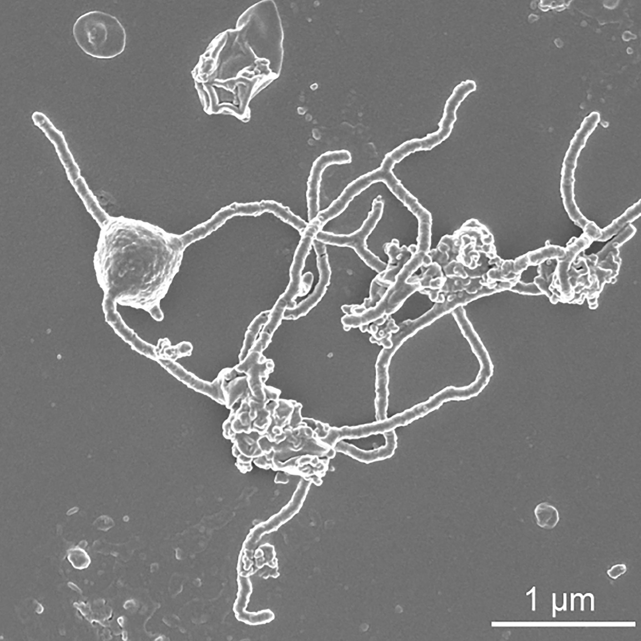 How the closest relatives of eukaryotes grew a larger genome