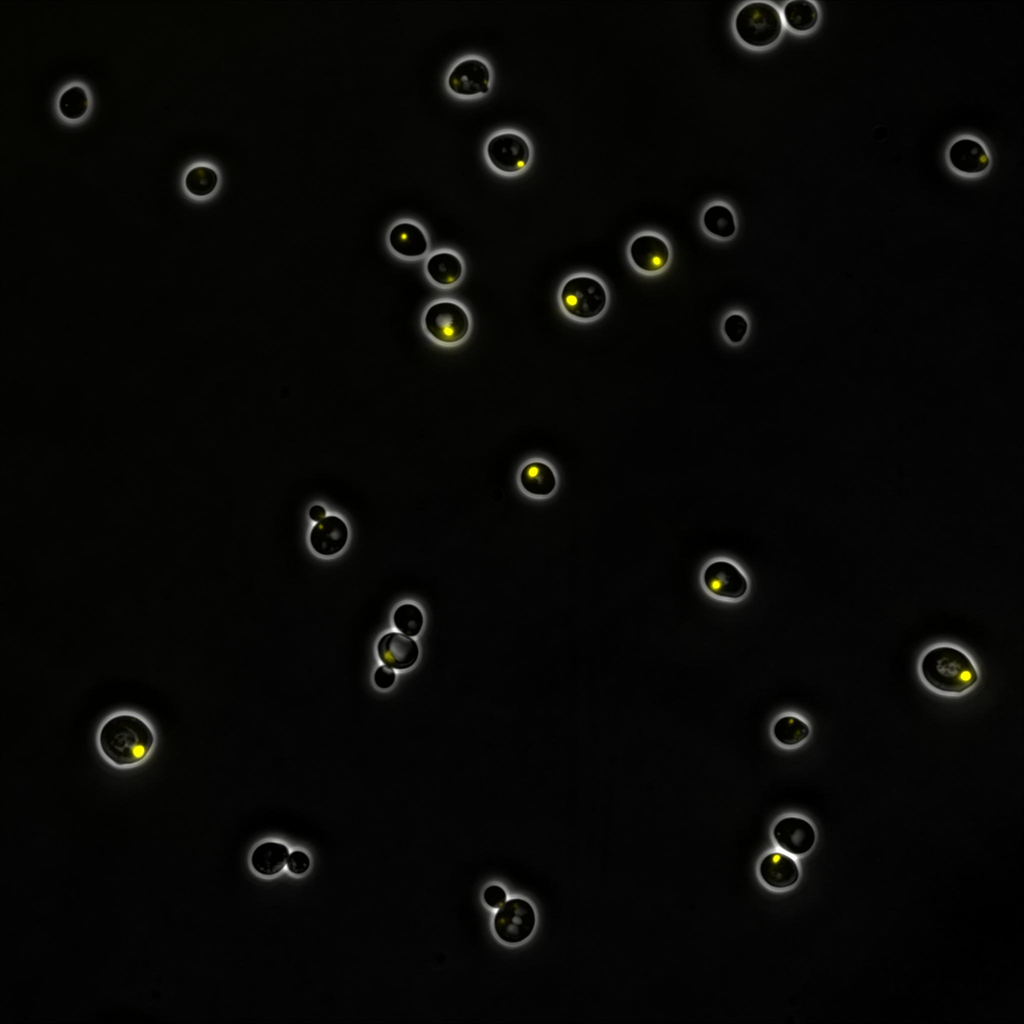 Protected by the peroxisome