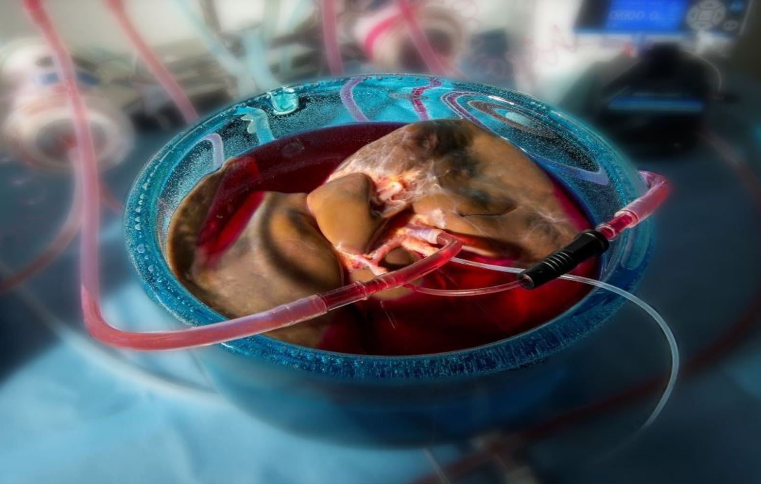 Supercooling extends preservation time of human livers 