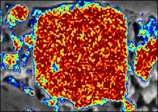 Behind the Degradation of Si-based Li-Ion Batteries – A Story about Solid Electrolyte Interface Reformation