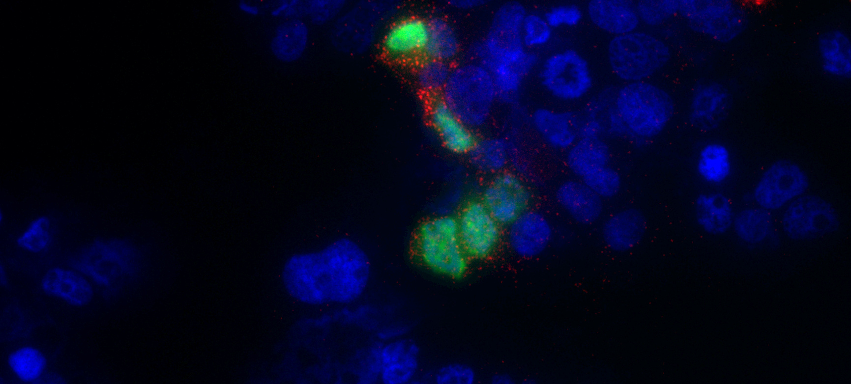 What Guided Us to DNA-Guided CRISPR