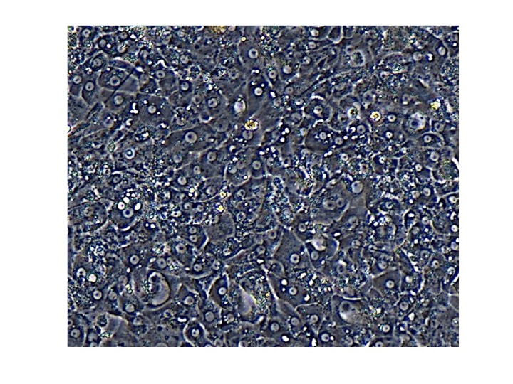 Modeling chronic hepatitis B virus infection in cell culture.