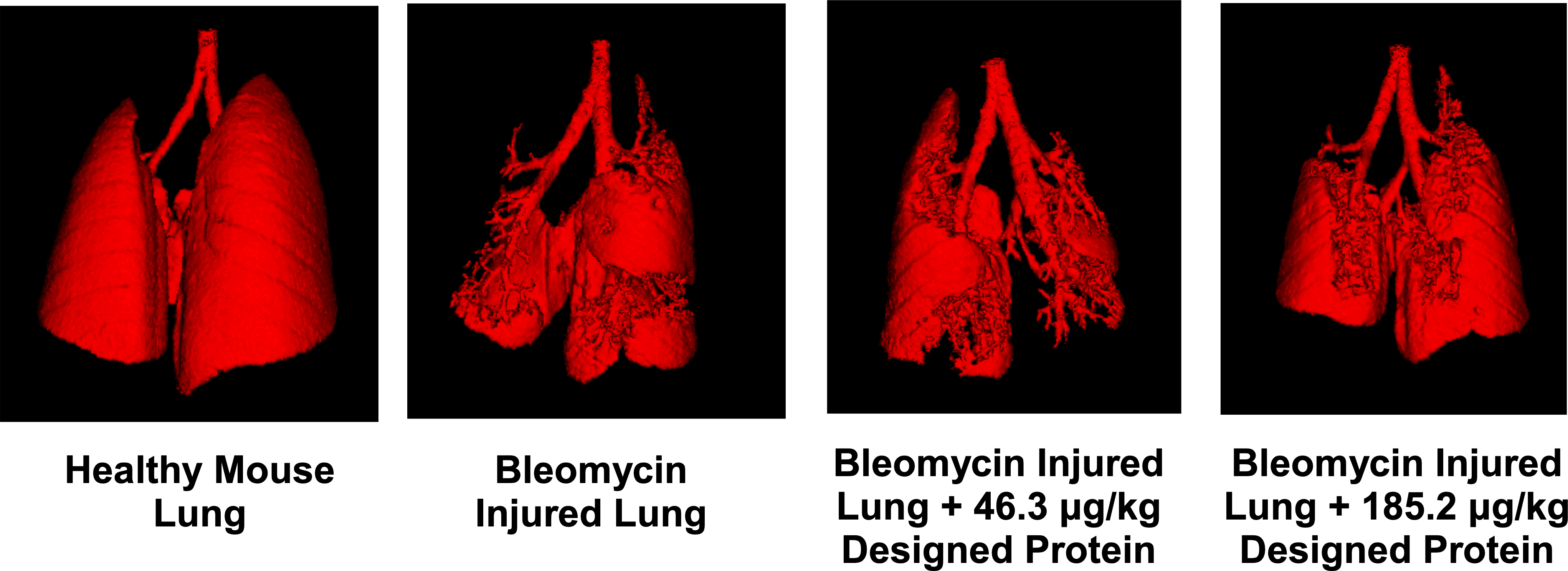 A Breath of Fresh Air: New Protein Inhibitors Offer Hope for Lung Fibrosis Patients