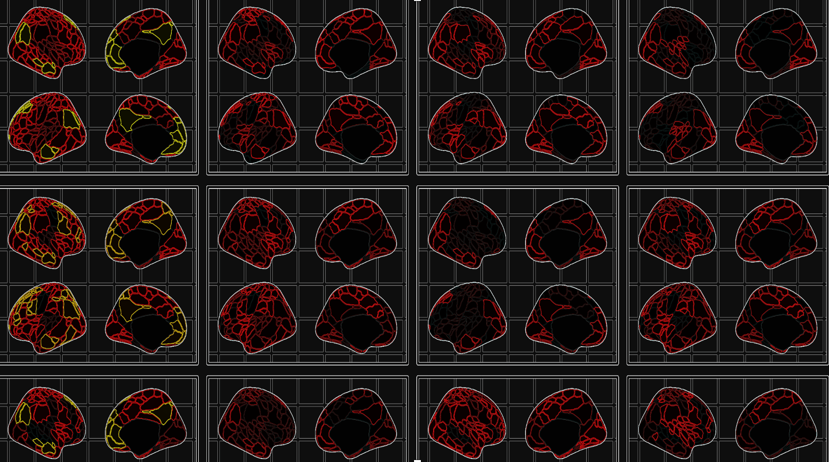 Mapping the Neurodevelopmental Predictors of Psychopathology