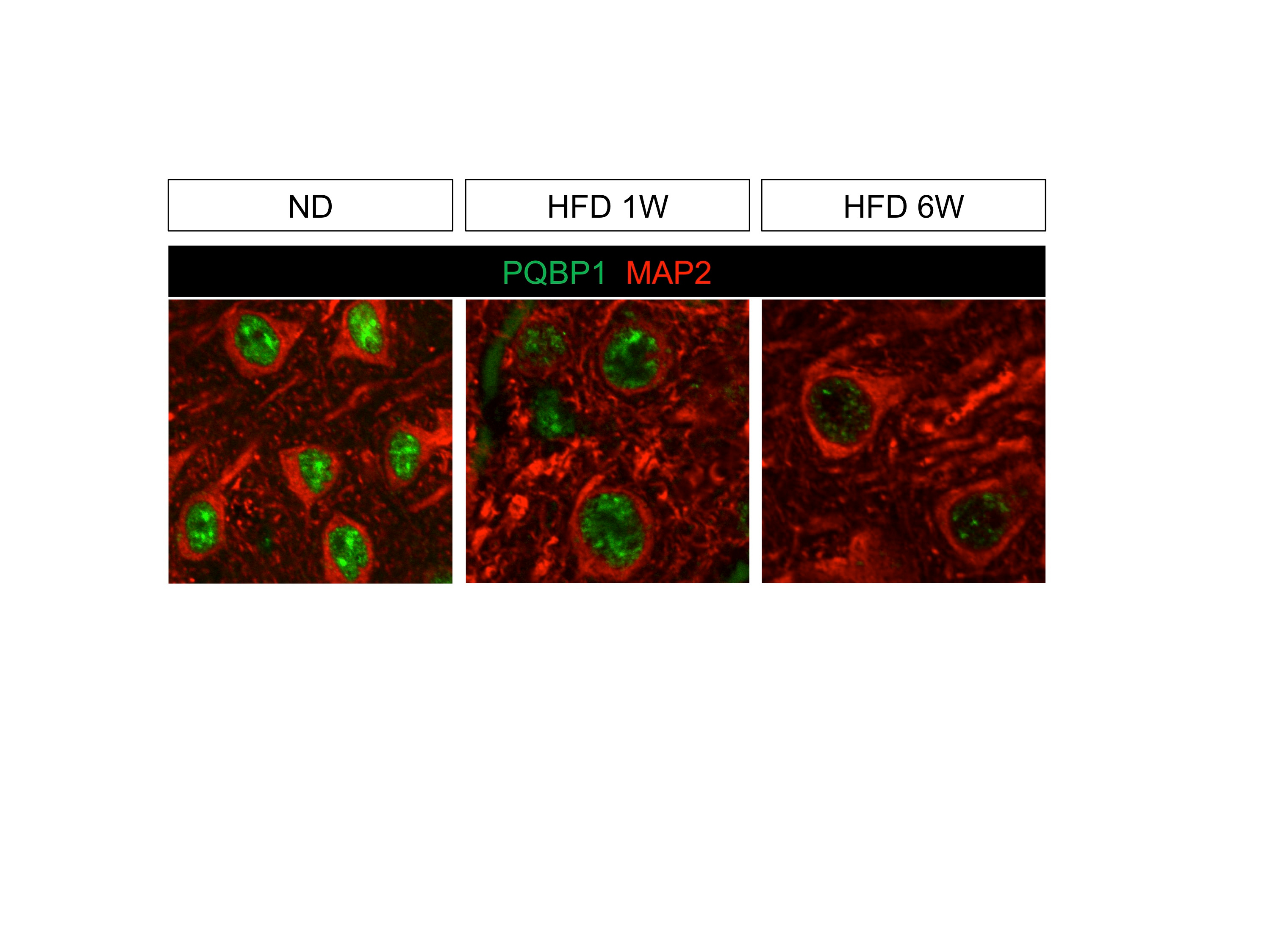 Polyglutamine binding protein 1(PQBP1) mediates high calorie-induced cognitive impairment