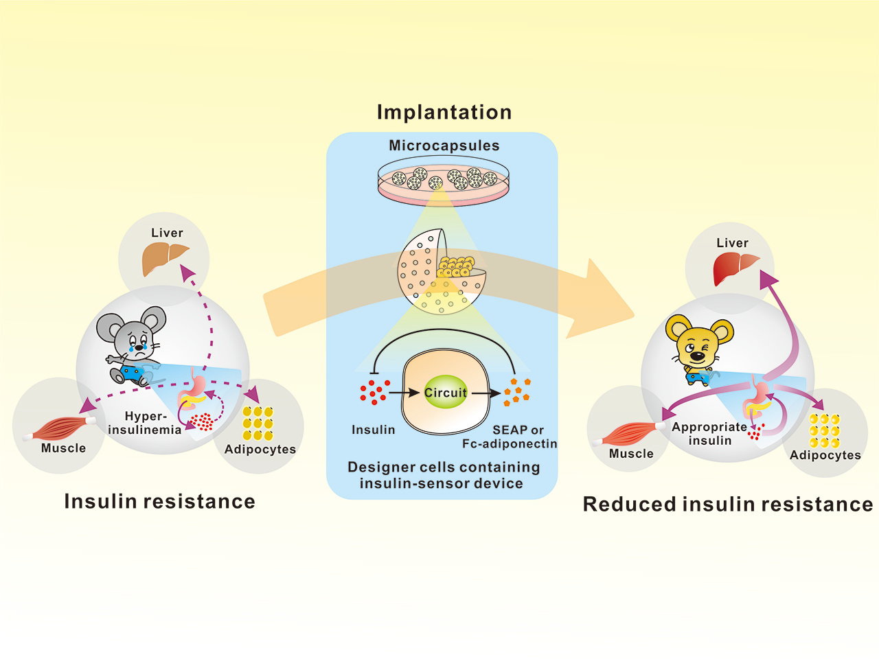 A smart insulin-sensor device for correcting insulin resistance