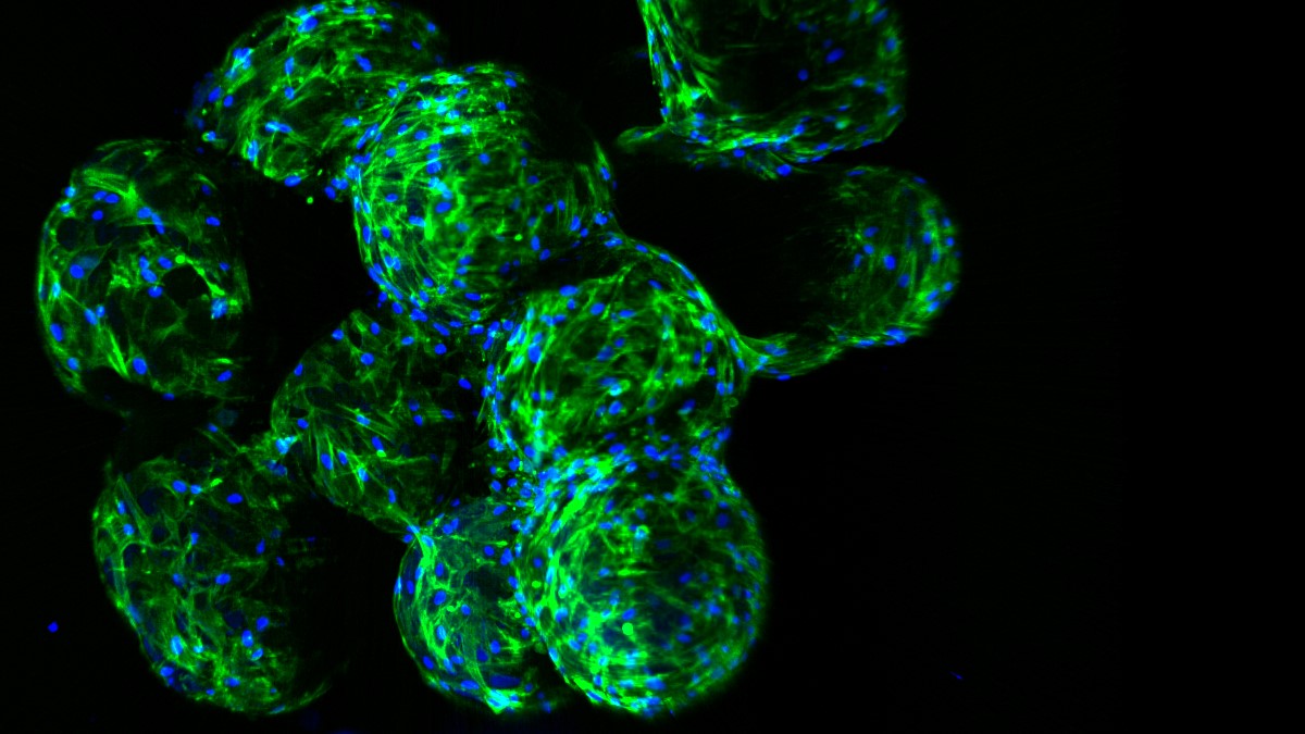 Cultured meat platform developed through the structuring of edible microcarrier-derived microtissues with oleogel-based fat substitute 