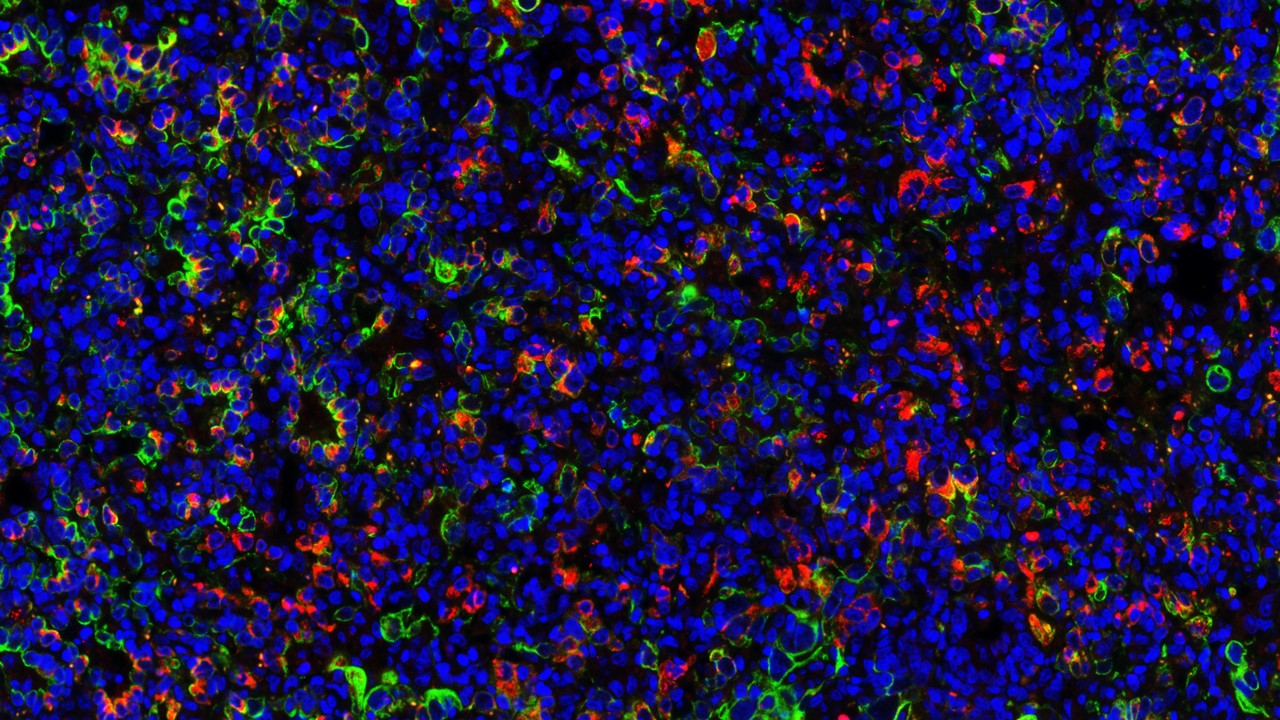 Could hamsters be a model for  respiratory  post-acute sequelae of SARS-CoV-2 ?