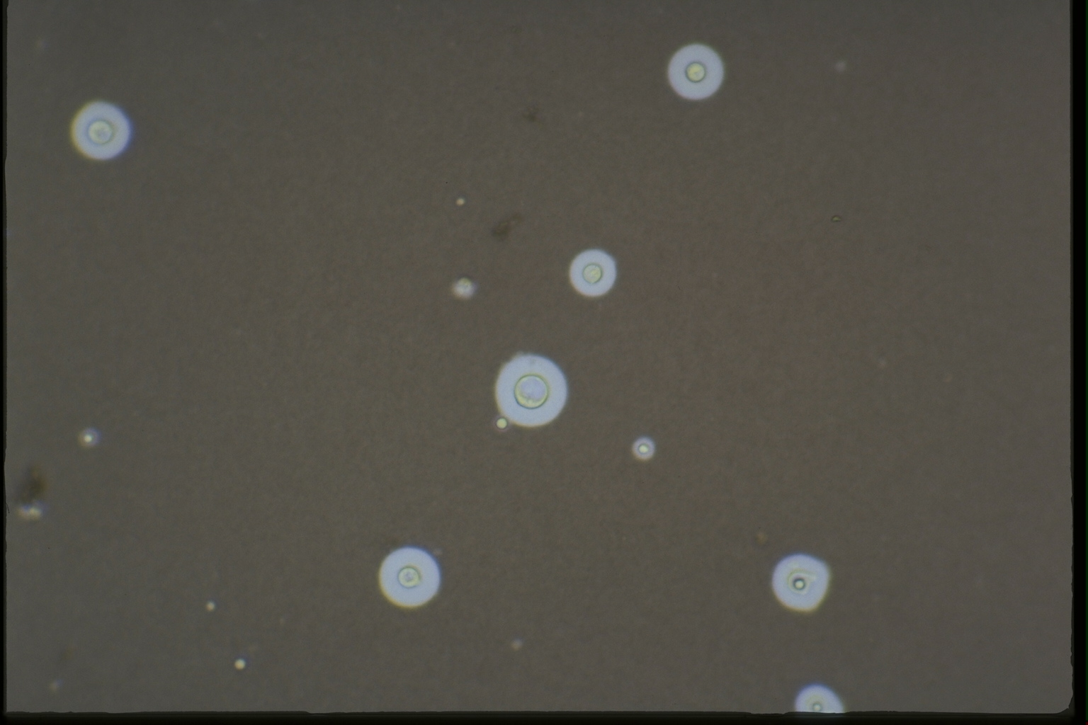 Diagnosing fungal infections: The not so FUN part of FUNgal pathogenesis