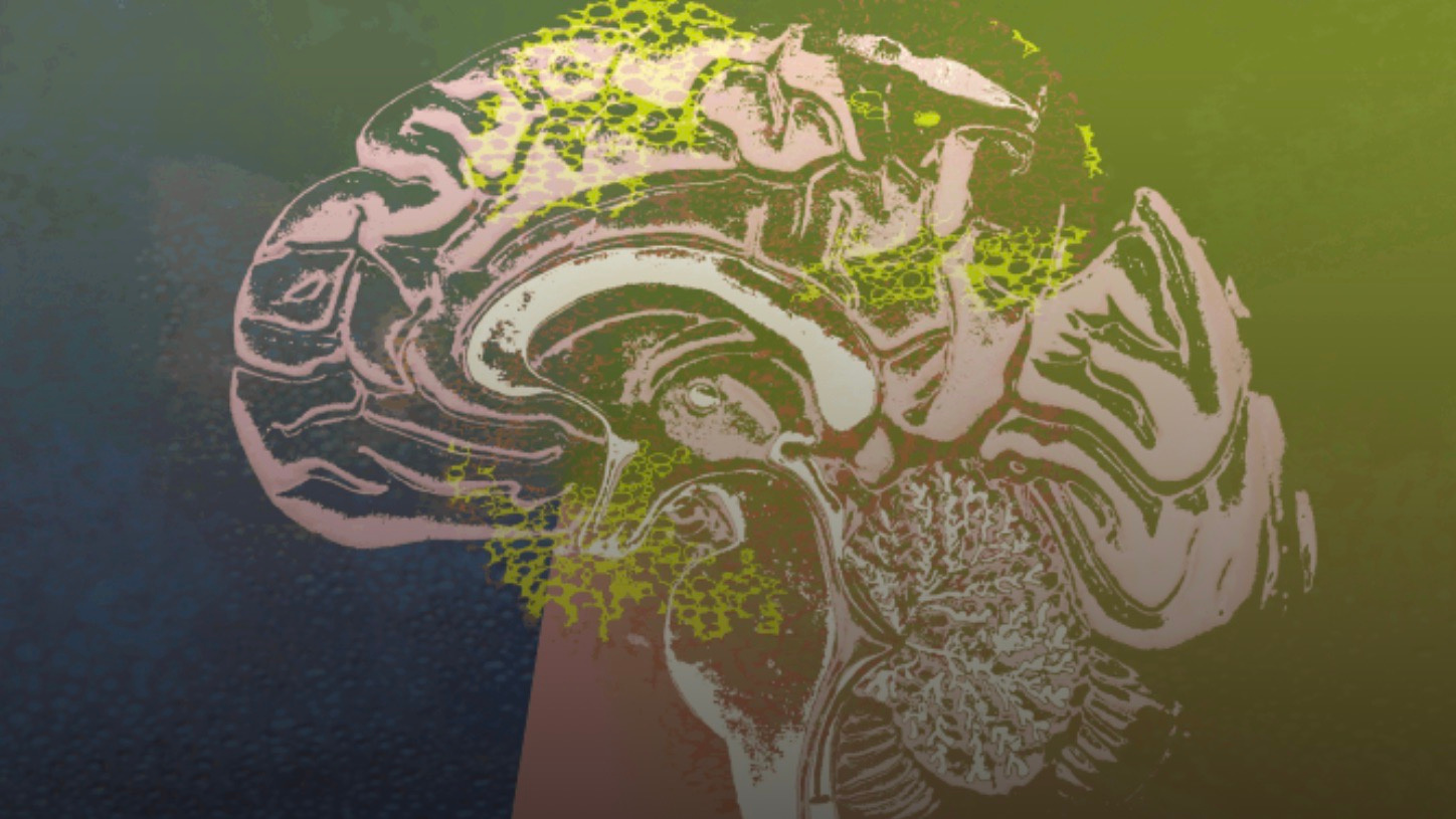 Electricity and the brain