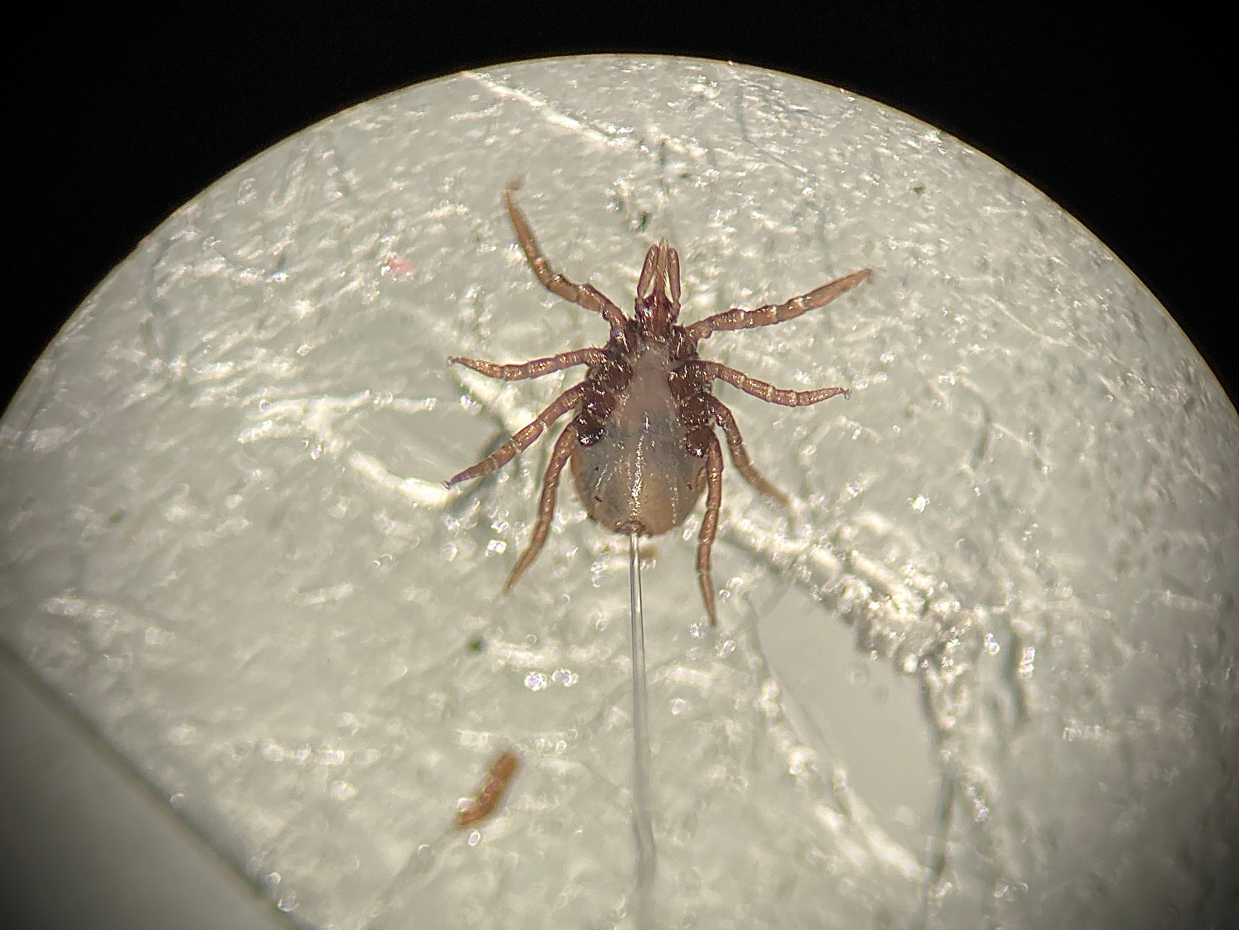 The Hidden Faces of Tick Immune Cells: Navigating Fitness and Microbial Challenges