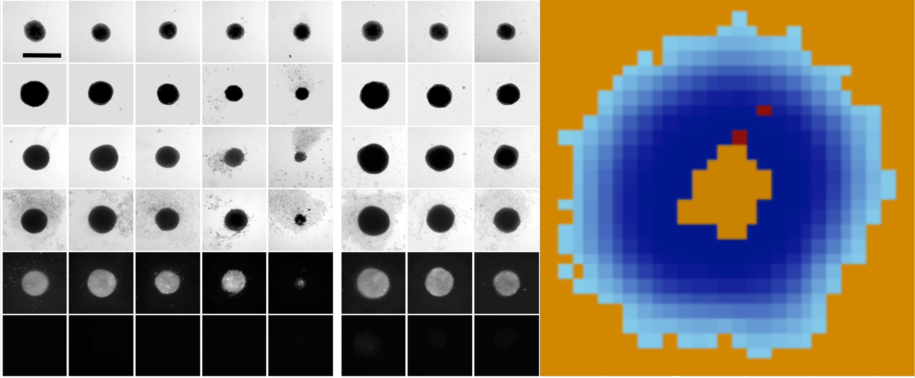 Suppressing resistance to cancer therapy