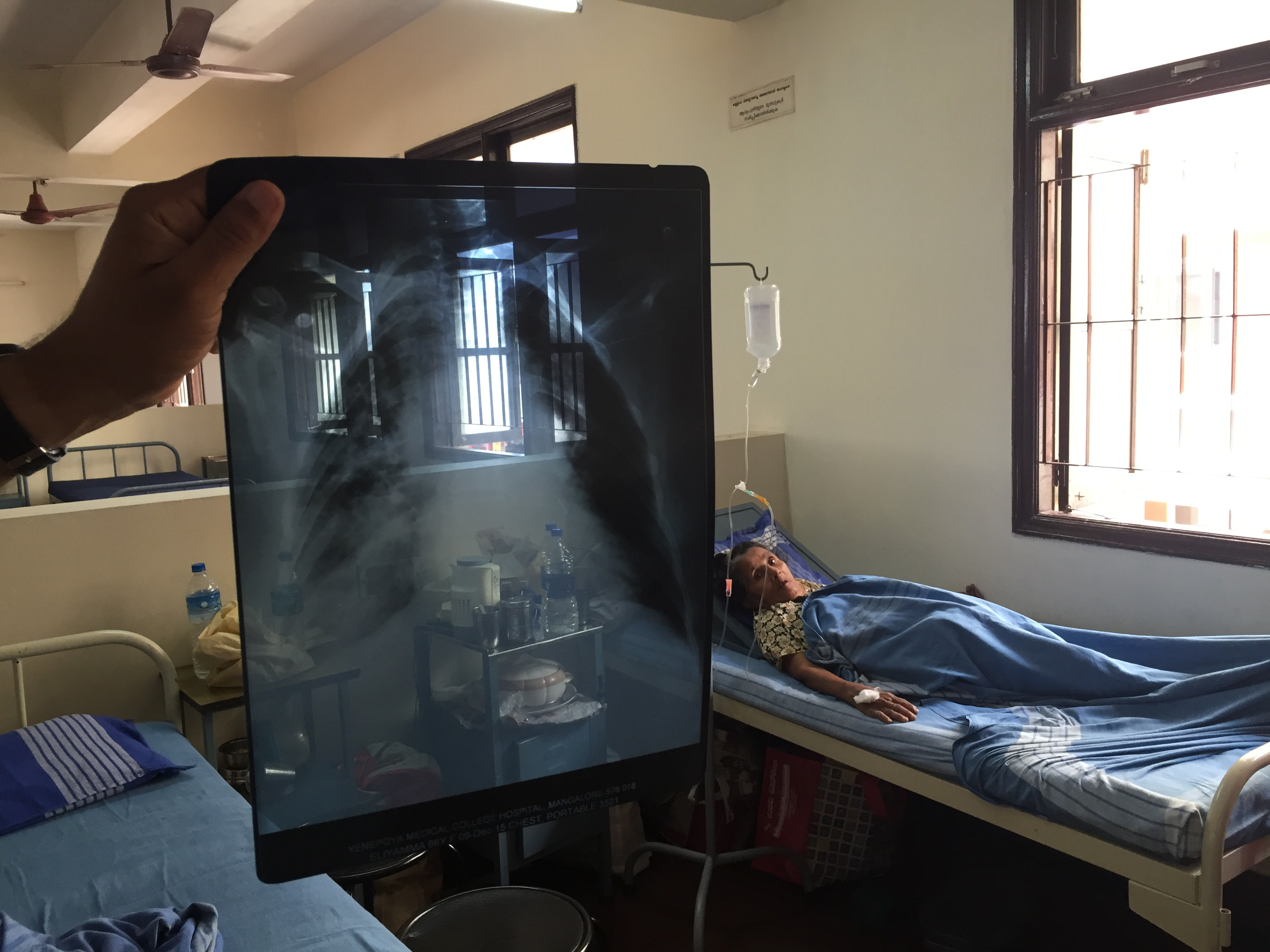 My take on the 2016 Global TB Report by WHO