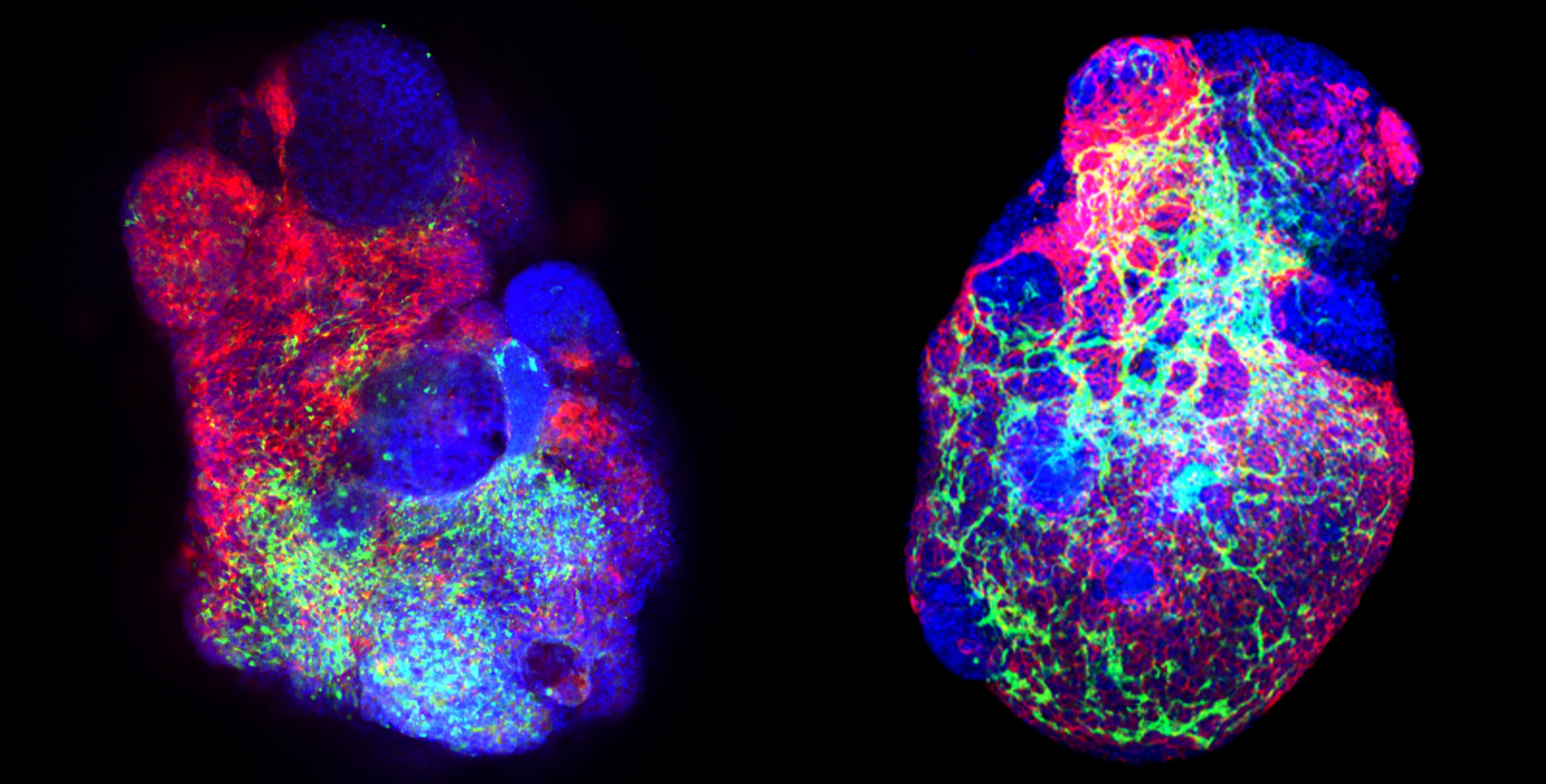 Growing patterned human primitive heart organoids via pluripotent stem cell self-organization 