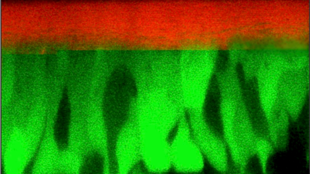 Mucosa exposed to a warming atmosphere share risks faced by planetary vegetation  