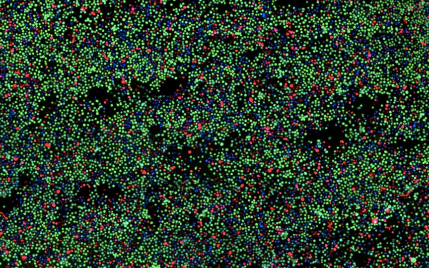 Targeting N-myristoyltransferases in cancer: when the end justifies the means
