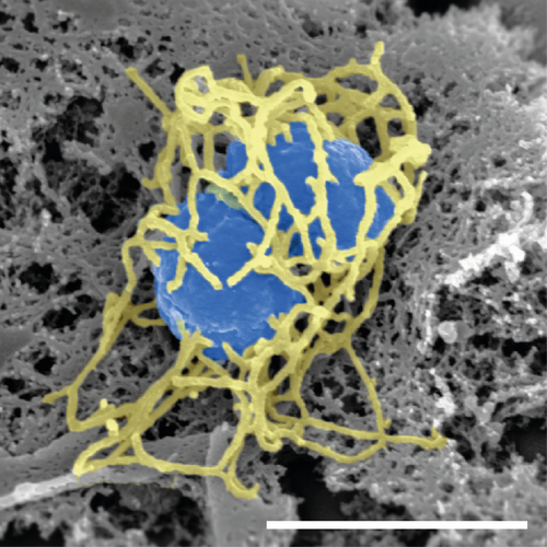 What the Kent meningitis outbreak revealed about meningococcal evolution
