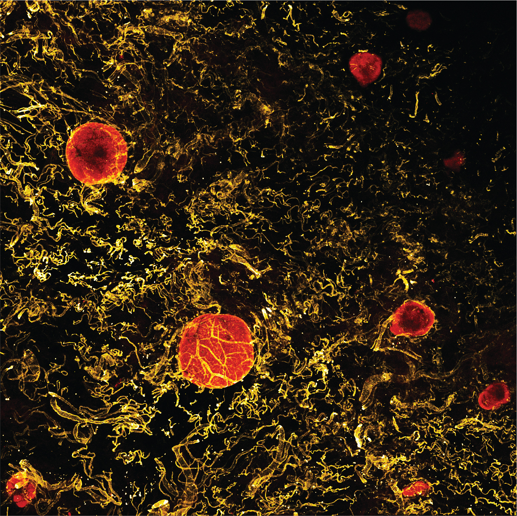 Peel to reveal: Dissecting out the intestinal immune system