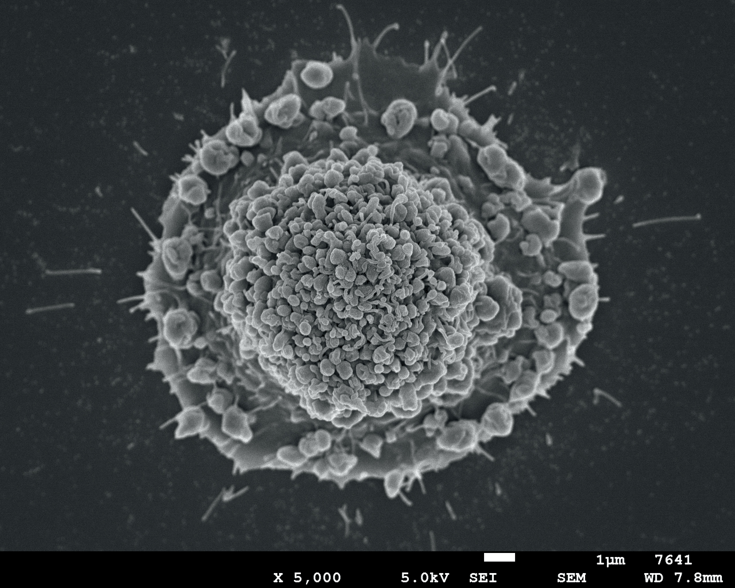 Platelets enhance malignant behaviours of gastric cancer cells via direct contacts
