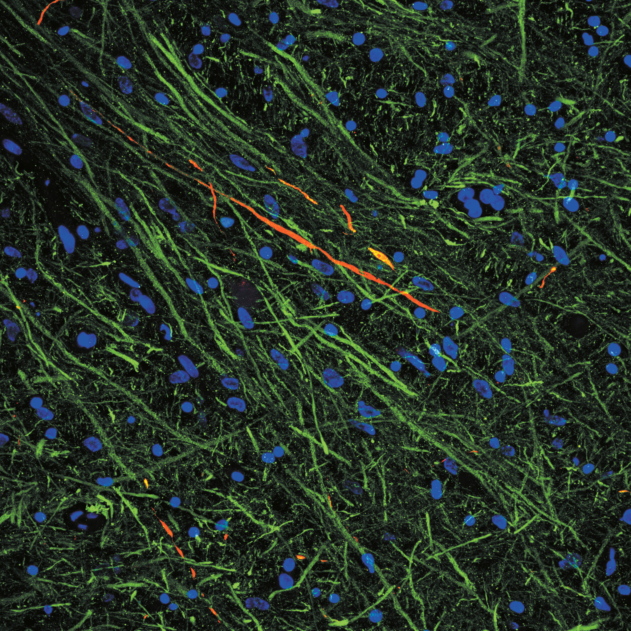 Deciphering the effects of COVID-19 on the Brain