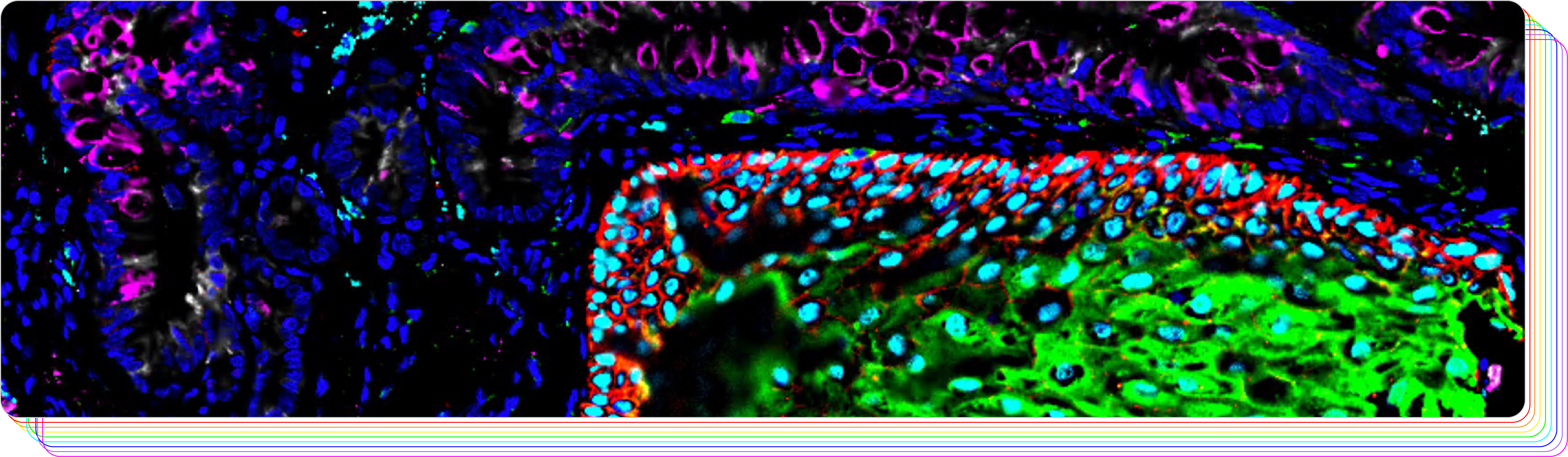 CODEX Multiplexed Imaging - Entering the Age of Technicolor Histology