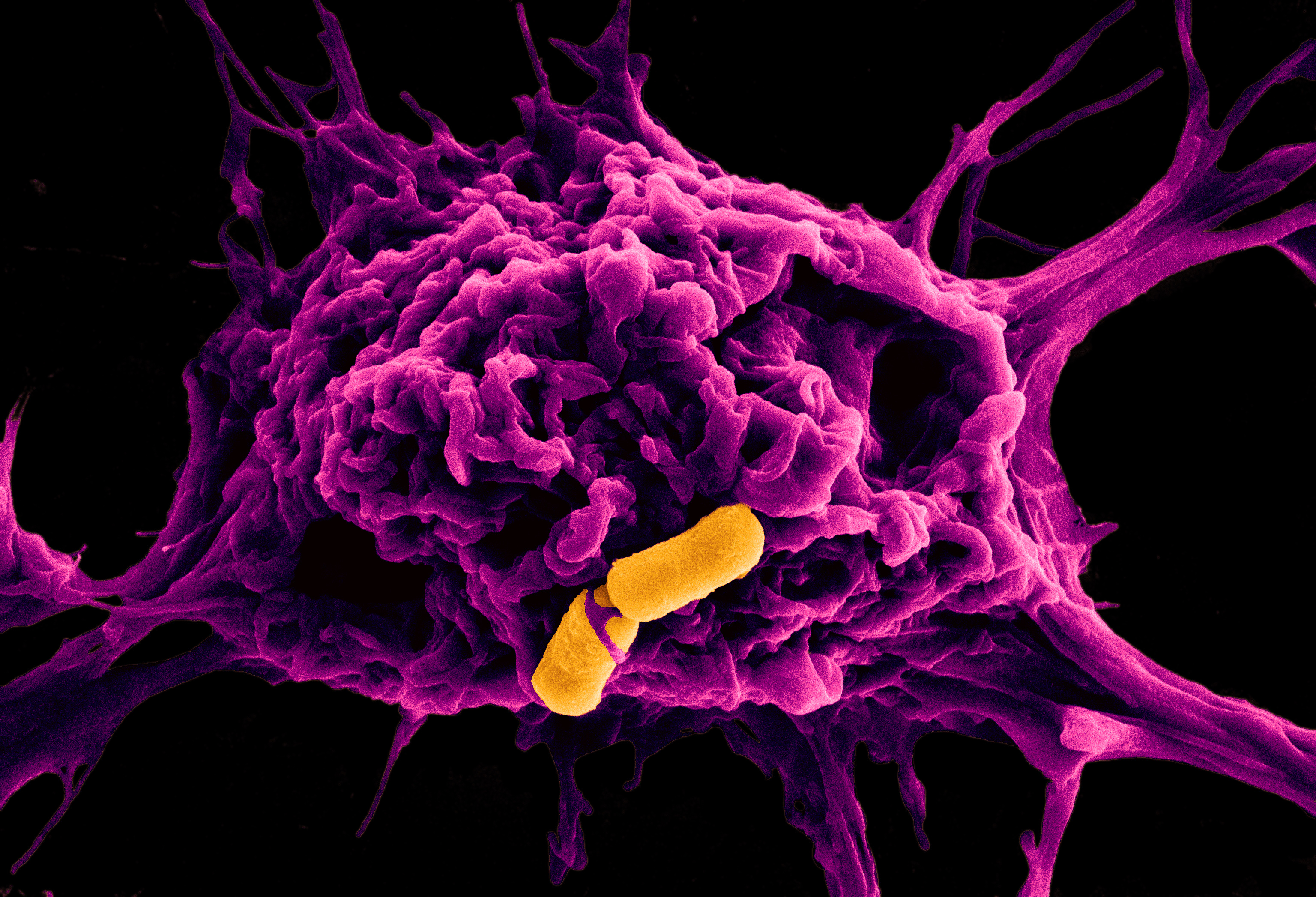 Toxin-induced inflammation and death: a cereus business