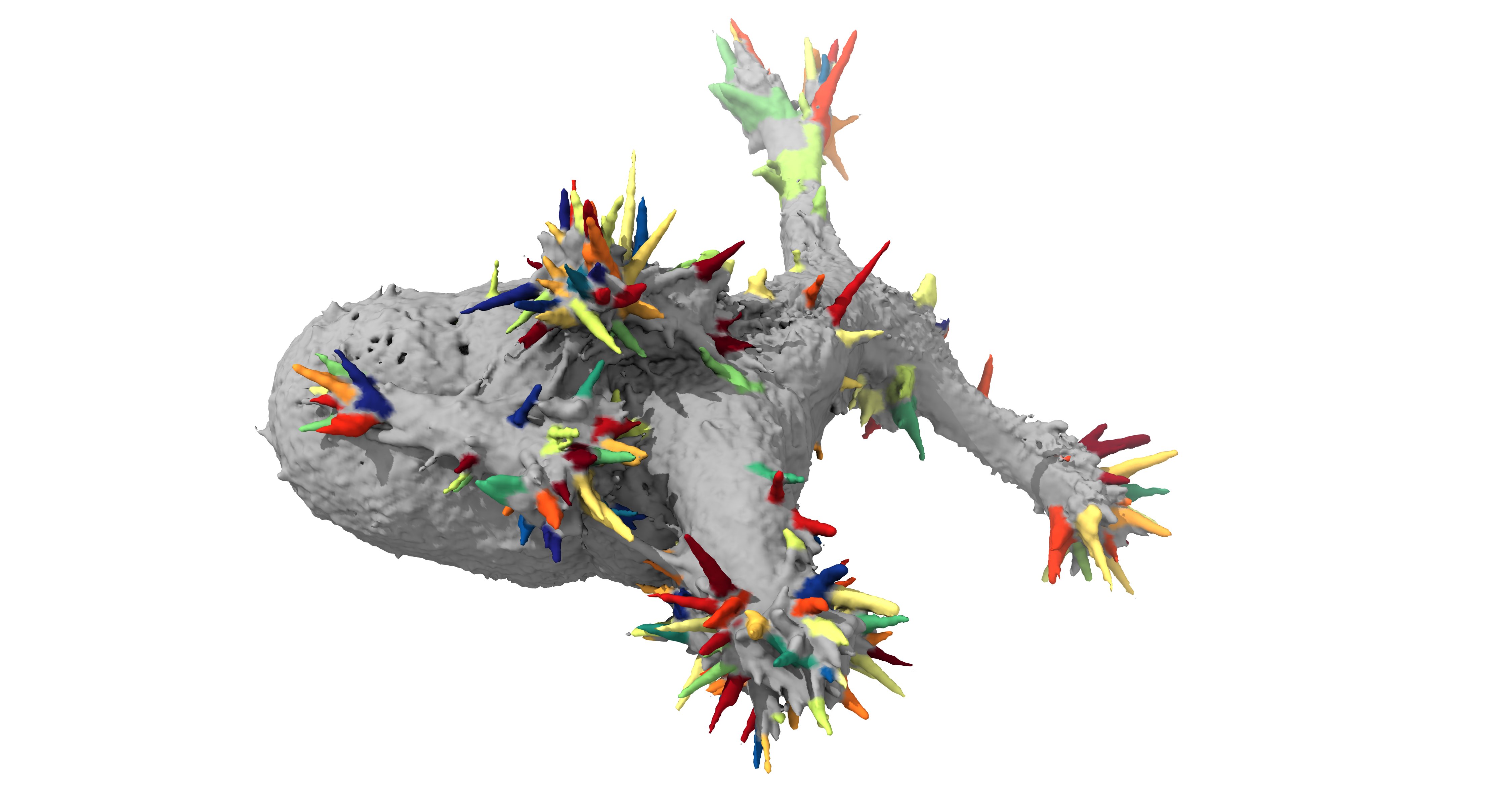 Automatically detecting subcellular morphologies with u-shape3D
