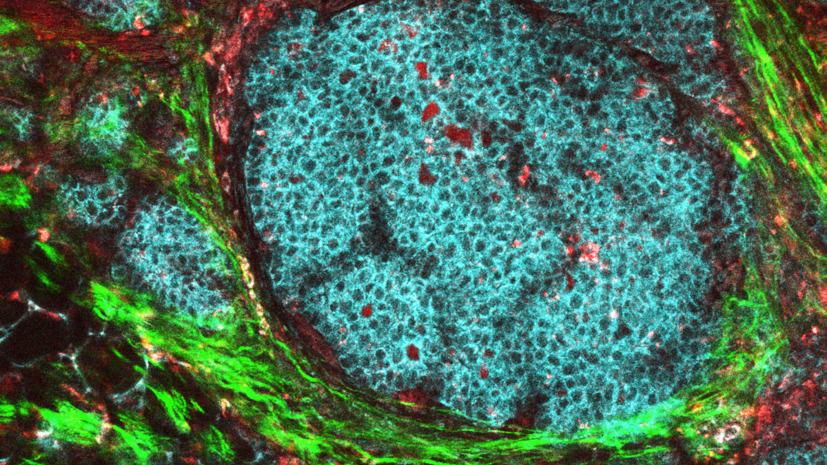 Call for papers: Tumor Microenvironment Crosstalk and Therapeutic Implications