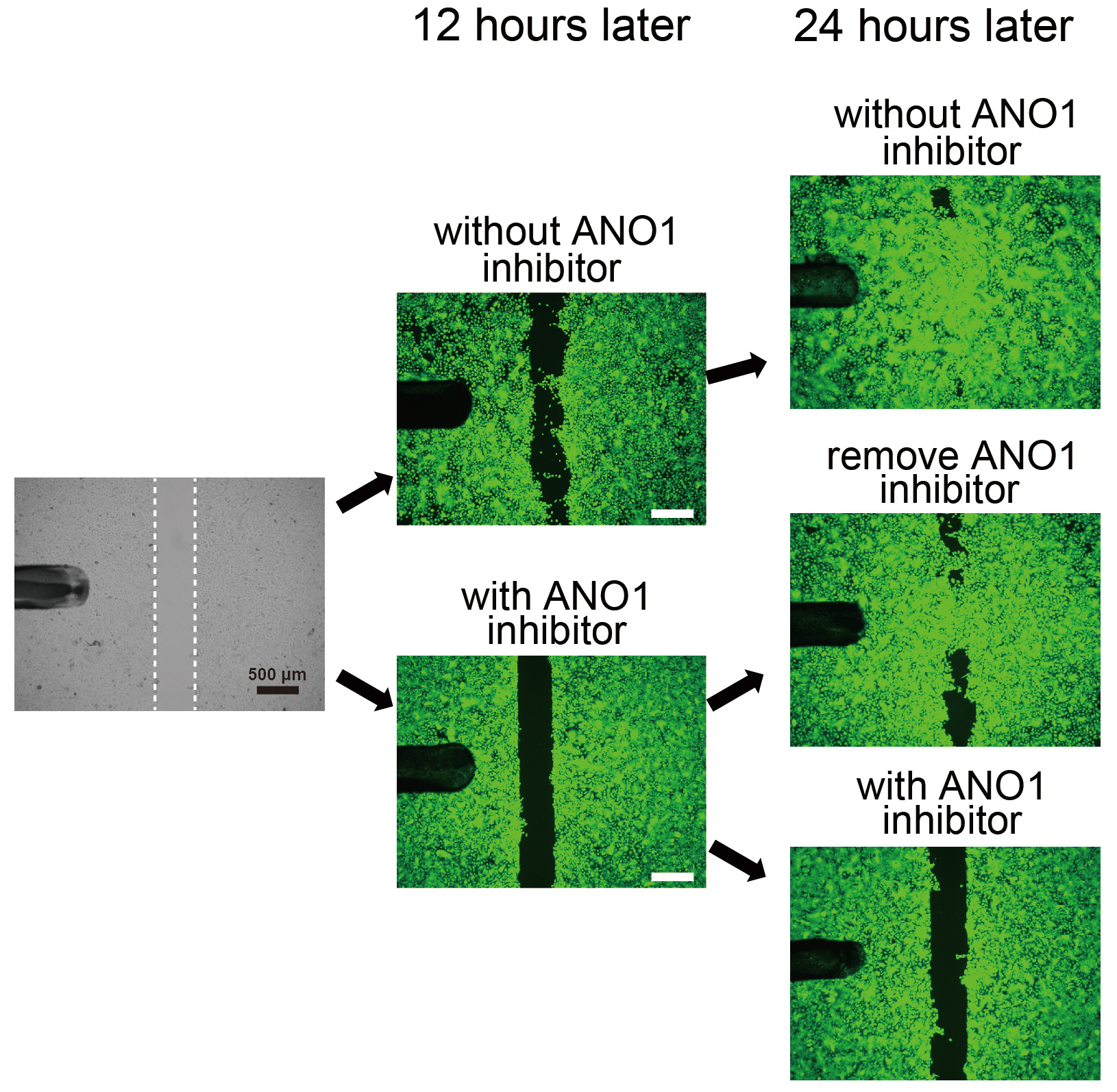 TRPV3/ANO1 interaction in wound healing