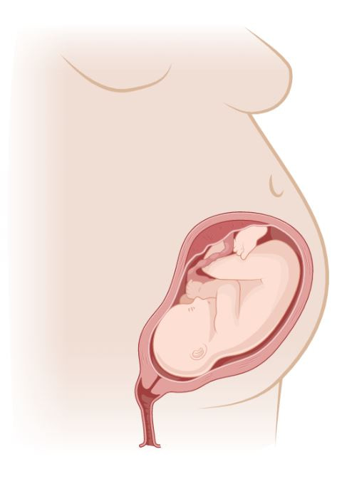 Understanding sex differences in placental function – Does X mark the spot?