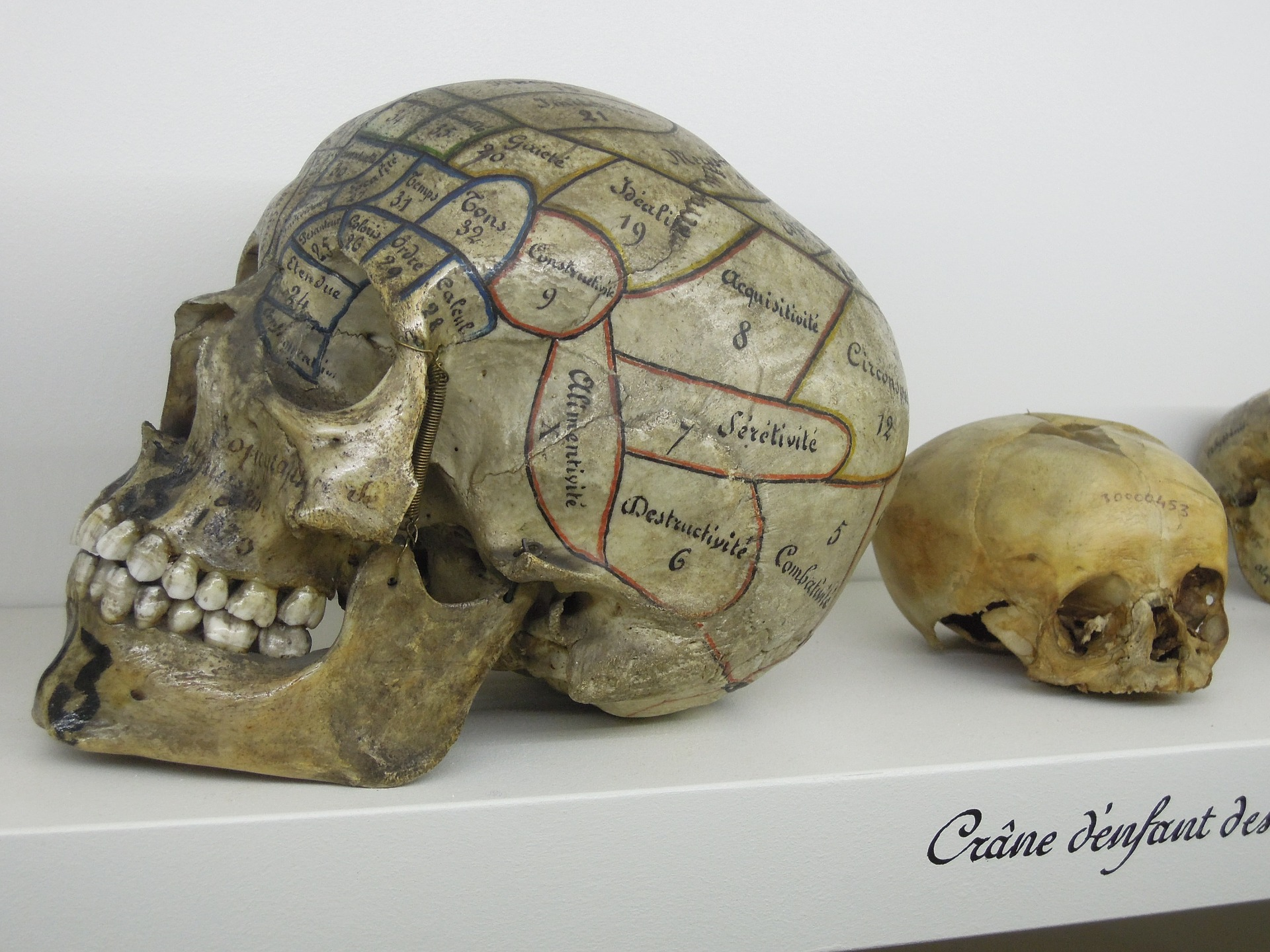  “Morbid curiosity” and the brain