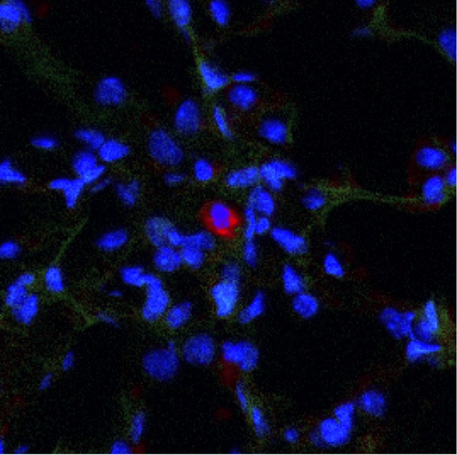 Metastatic dormancy in breast cancer depends on CD39+ PD-1+ CD8+ T cells 