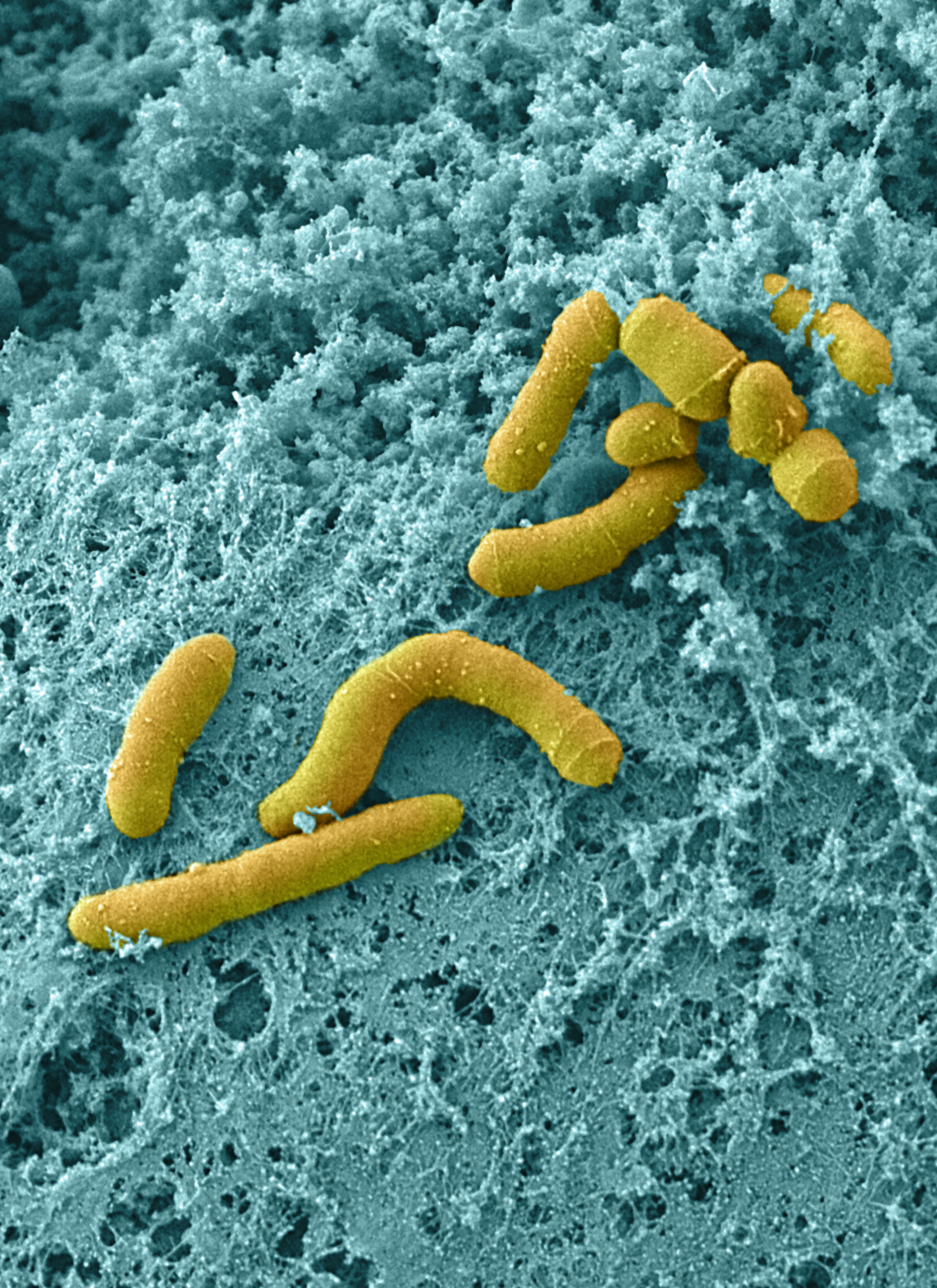 Studying Human-Microbiome Interactions using Organ Chip technology 