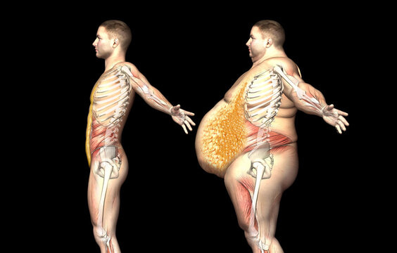 The association of body composition and fat distribution with dysmobility syndrome in community-dwelling older adults
