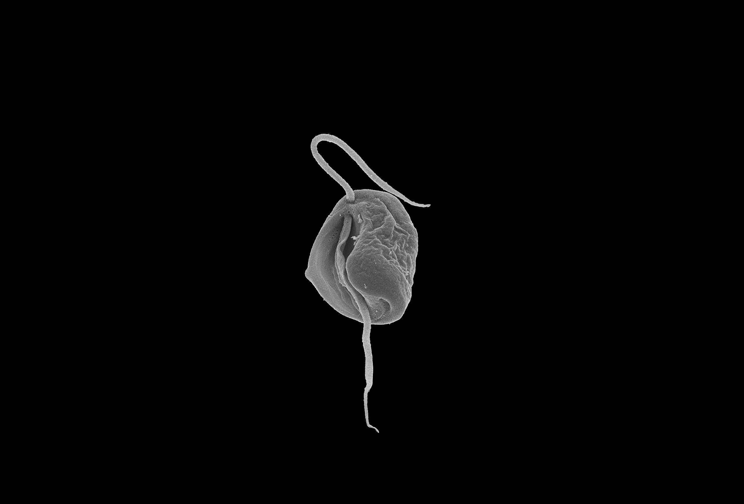 Endless forms most wonderful: new forms of mitochondria in free-living microbial eukaryotes