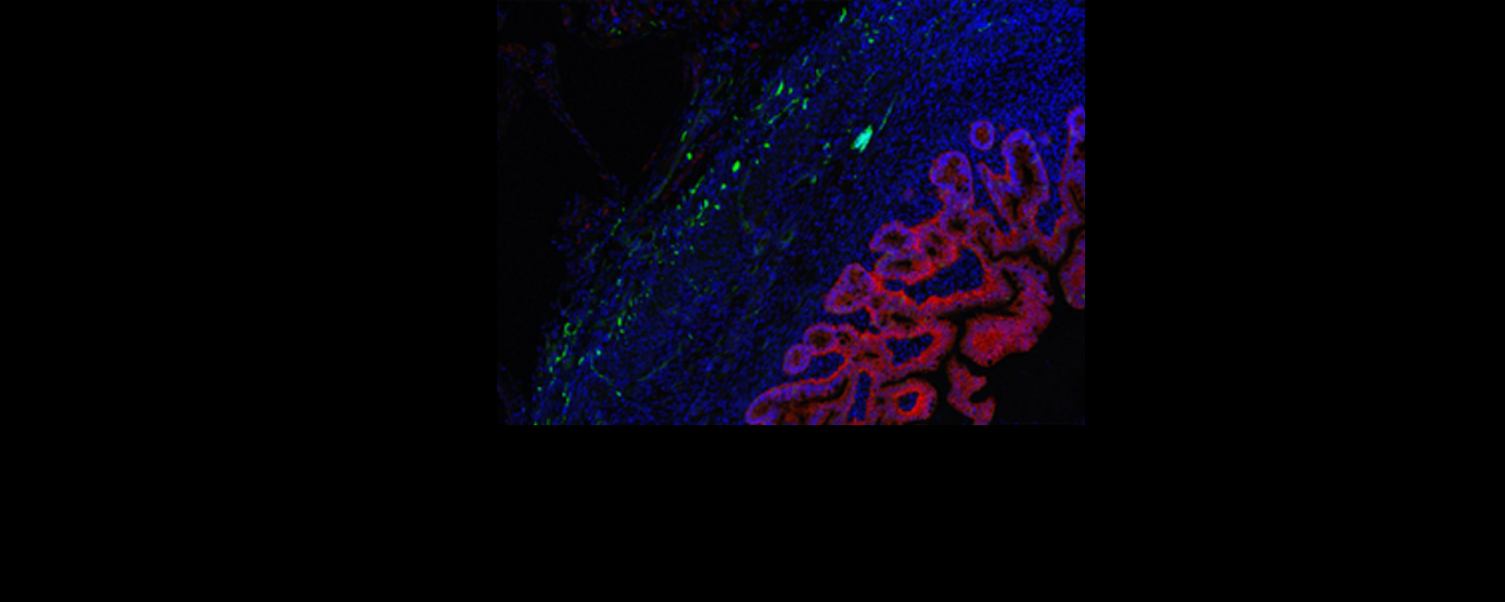 Waves of combined nerve and intestine stem cells