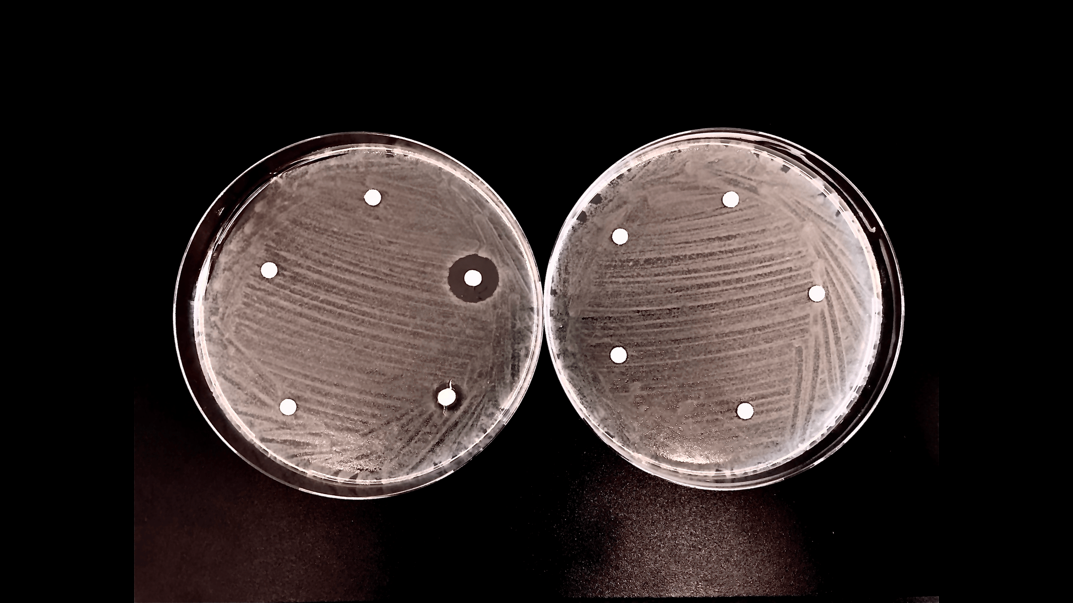 Marine environments harbor a large reservoir of antibiotic-degrading activities.