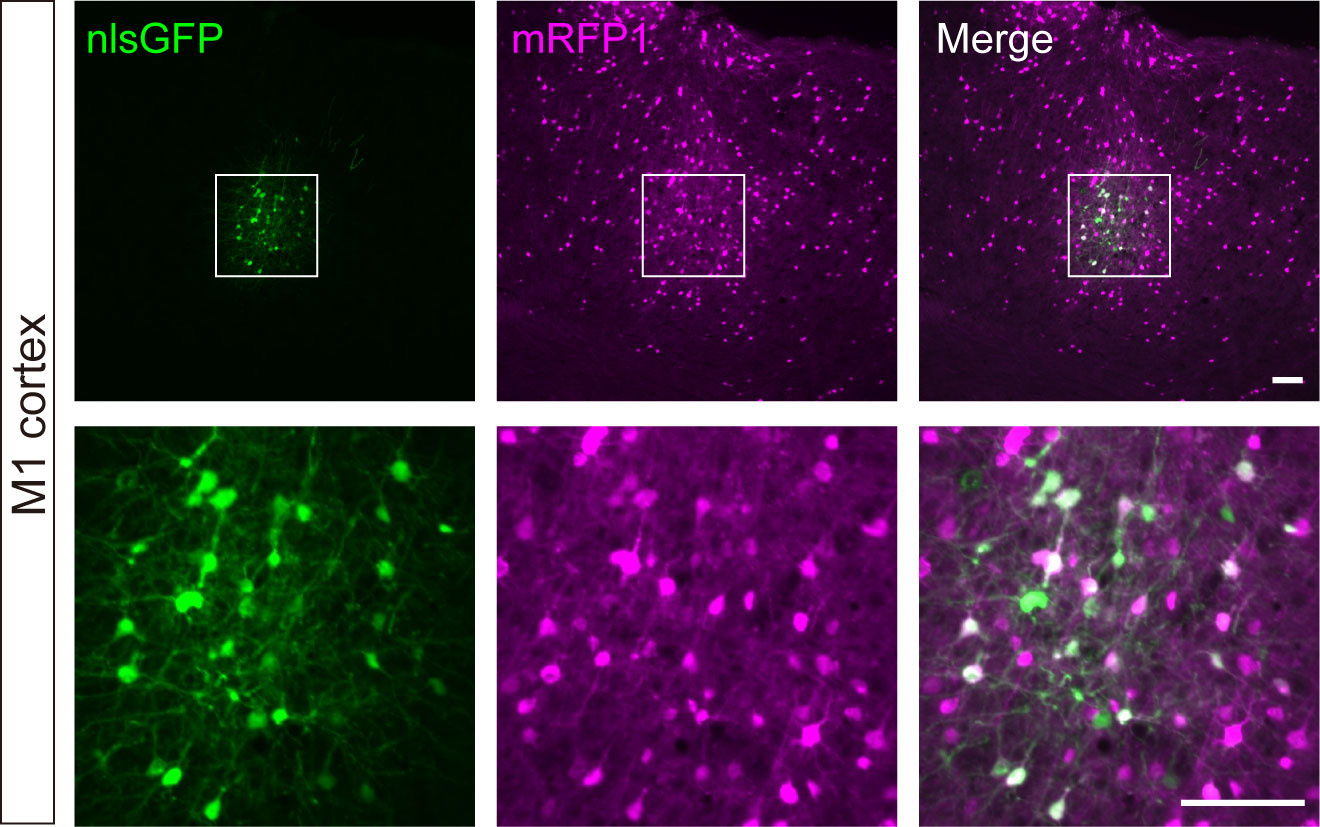 Cre recombinase dependent on protein X: GFP, RFP, and then?