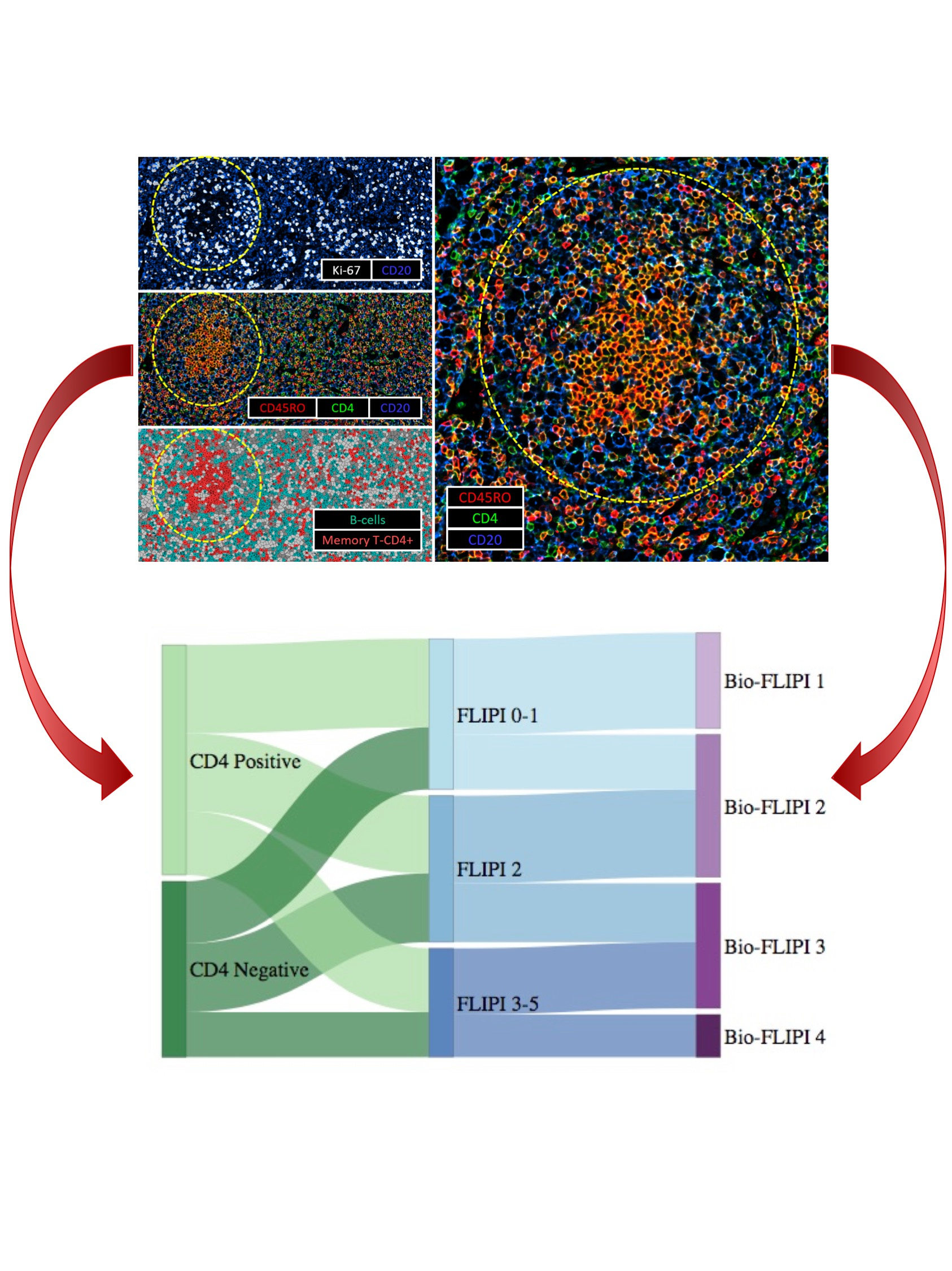Exploring the dark side of the immune microenvironment in Follicular Lymphoma