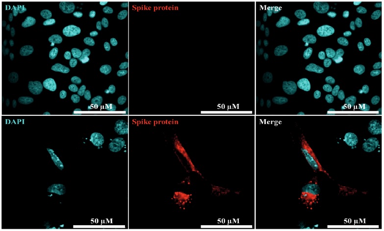 T cells, but not nAbs, mediate immunity to the omicron variant of SARS-CoV-2